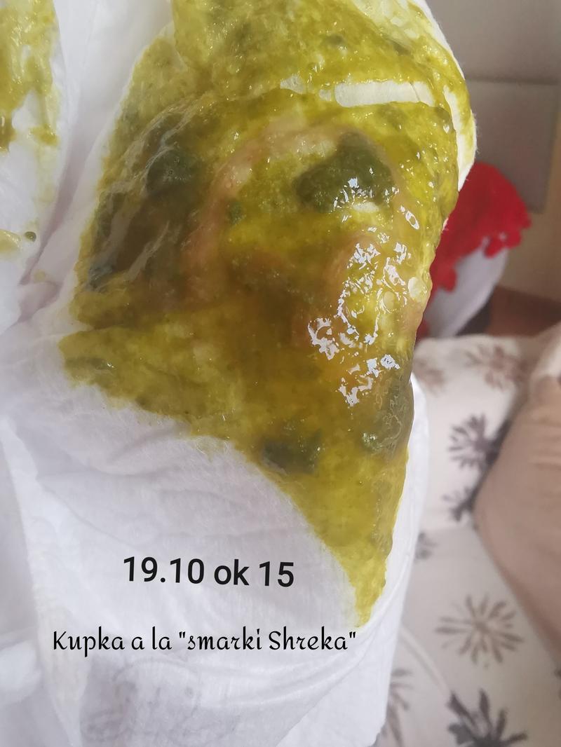 Dieta a wypróżnienia