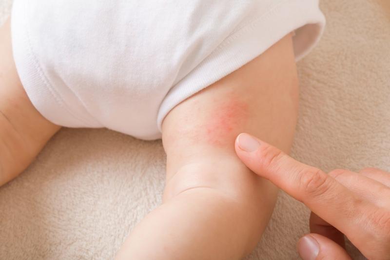 Czynniki ryzyka u niemowląt