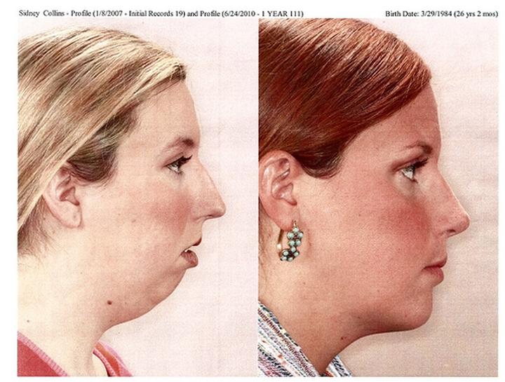 Ćwiczenia oddechowe dla dzieci