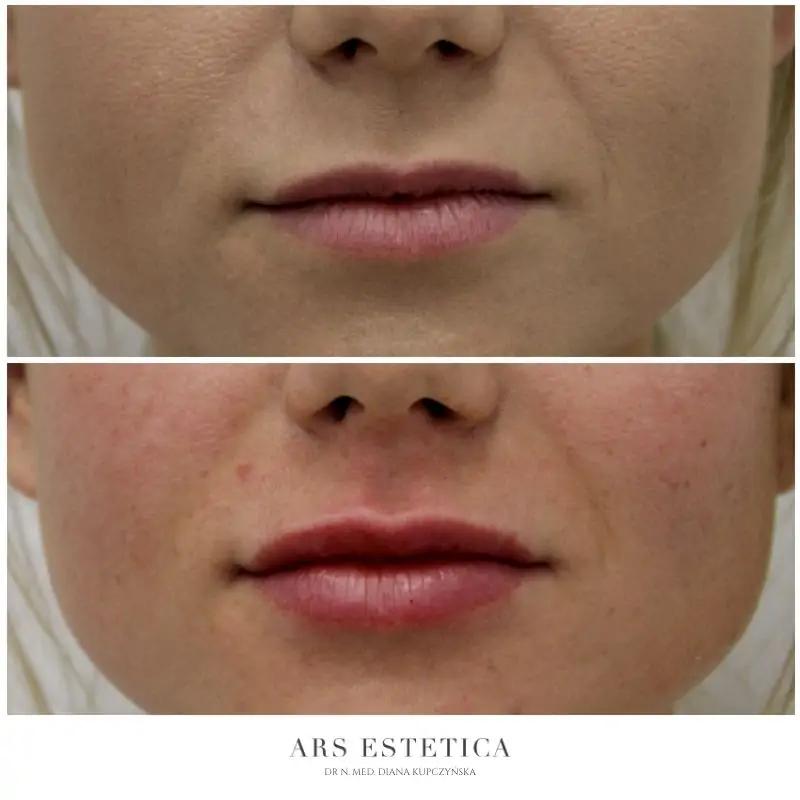 Bezpieczeństwo zabiegów estetycznych w ciąży