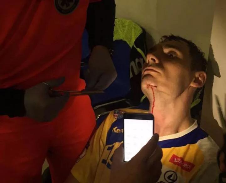 Kiedy nie trzeba szyć rany