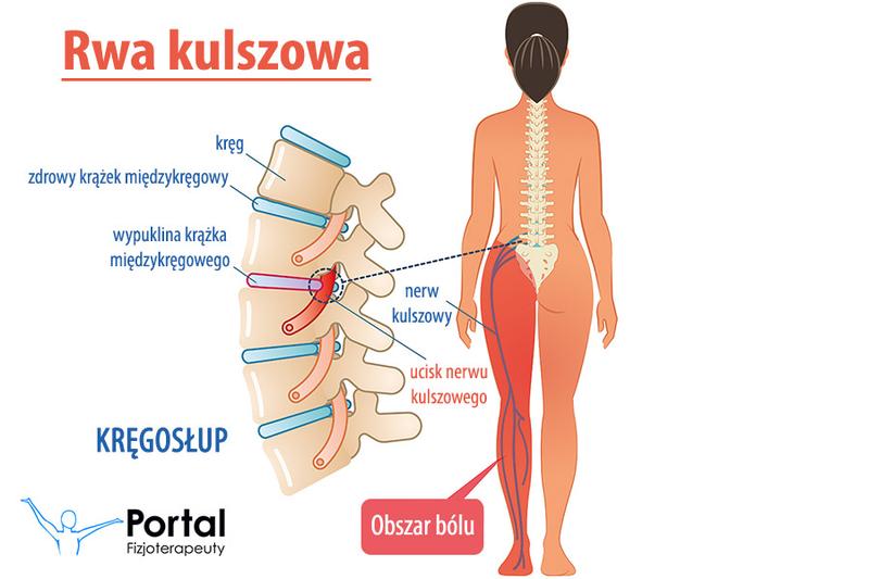 Naturalne metody łagodzenia bólu