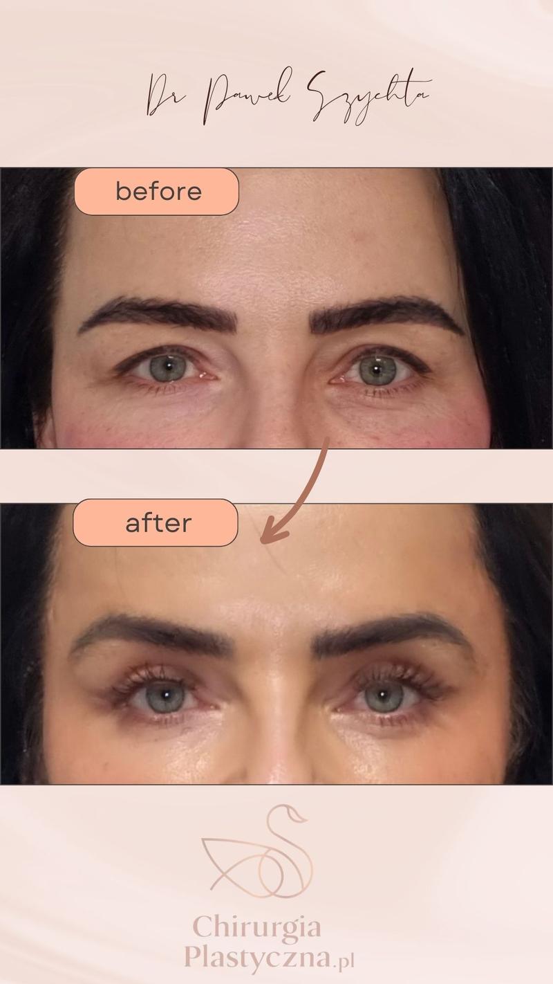 Zabiegi kosmetyczne w ciąży