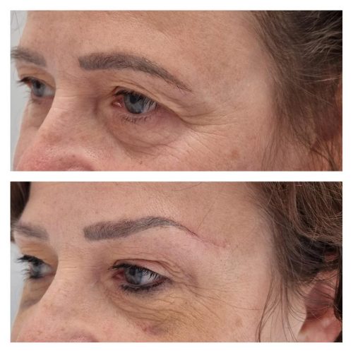 Lifting i laminacja brwi oraz rzęs w ciąży – czy to bezpieczne?